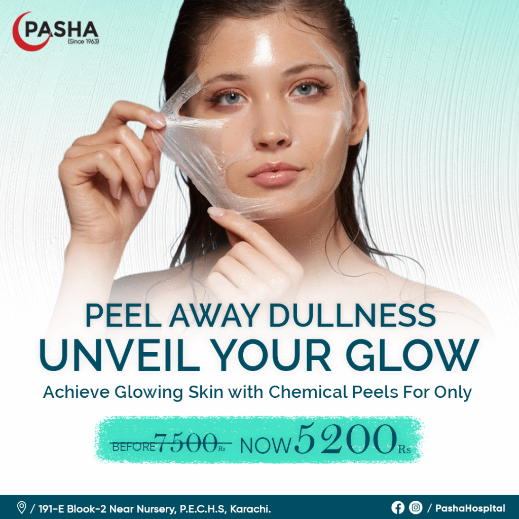 ChemicalPeel1